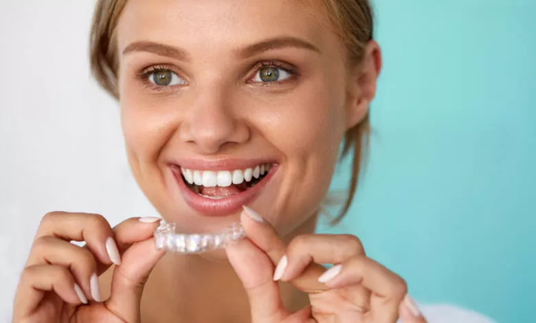 clear aligners vs braces