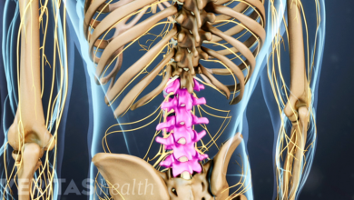Photo of Vertebral Bends And Their Scoliosis treatment