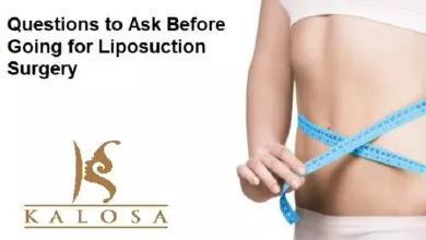 Liposuction Surgery